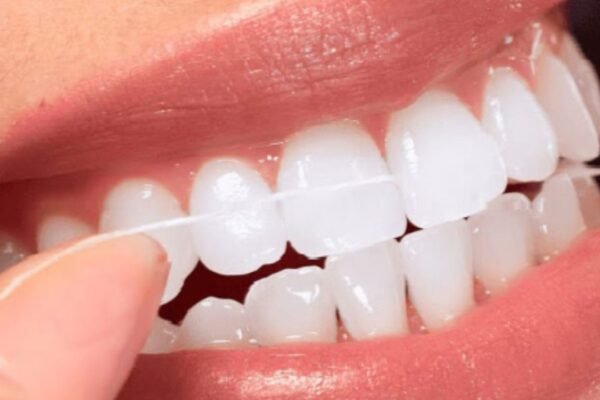 Healthy Gums