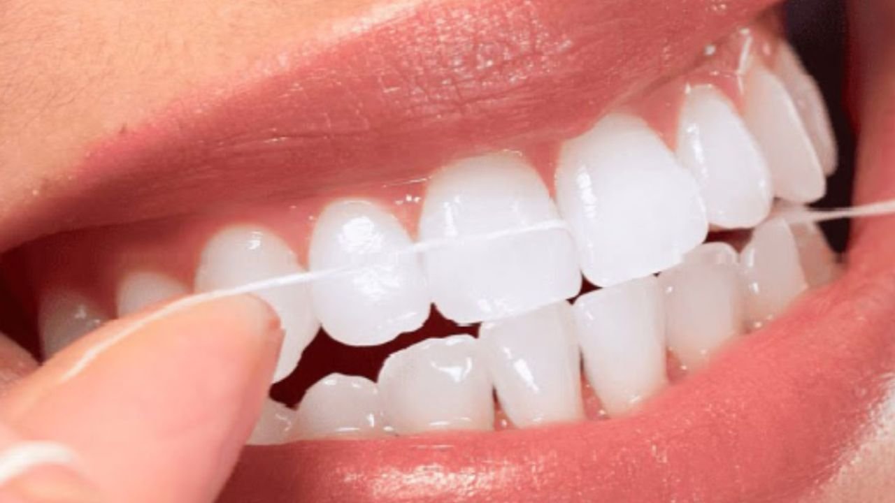 Healthy Gums